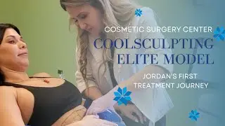 Jordan's CoolSculpting Elite Journey | Dr. JoAnne Lopes MD | Cosmetic Surgery Center Virginia Beach