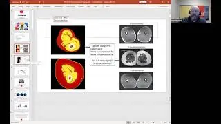 Dr  Dan Ritchie   The Physiology of Aging