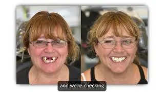 Dr. Rich answers some common dental implant questions!
