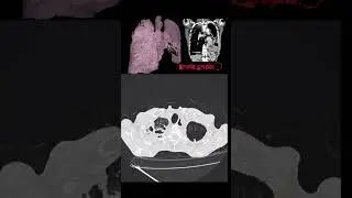 3dct#anatomy #ctscan #xray #doctor #nurse #viral #tranding #mri #science #student #study #xray