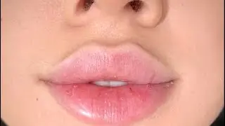 𝓈hort philtrum + lip flip ୨୧