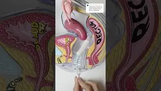 Tampon placement vs menstrual cup vs menstrual disc shown in models #shorts