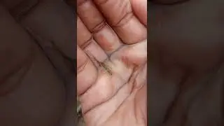 Insects underwater | Aquatic insects | Water bugs