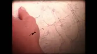 The 