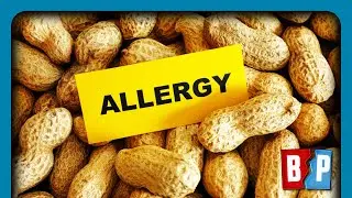 Hygiene Hypothesis Confirmed? Allergy Guidance REVERSED | Breaking Points