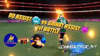 🔥 Who Wins? 🤔 Smart Assist ⚙️ vs Non-Smart 🧠 | 1v1 ⚔️ | 💥 Want a 1v1 match with me?👇 
