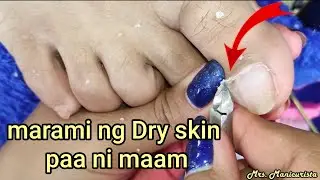Vlog187|Dry Skin/Ingrown Removal| PEDICURE 92