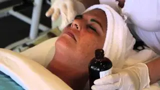 How to Use TCA Skin Peel : Healthy Skin Care