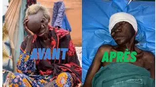 Plus de 10ans de souffrance et voici le miracle de Dieu !🙏🏼🥹☺️ 