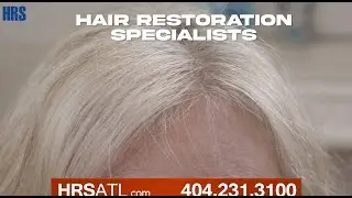 PRP (Platelet Rich Plasma) Hair Los Therapy for women