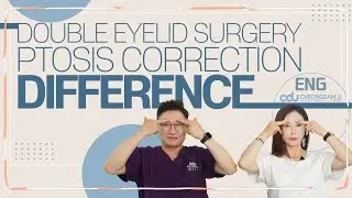 [ENG]Differences between Ptosis Correction vs Double Eyelid Surgery