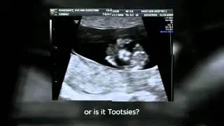 Hyemin's 11-week Prenatal Ultrasound