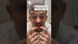 Зеваю с заклеенным ртом! 🤐🥱