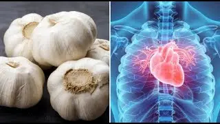 5 Miracle Cures of Garlic That Will Surprise You - Benefits Of Garlic For Your Health