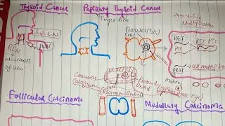 FOLLICULAR AND MEDULLARY CARCINOMA OF THYROID | ENDOCRINOLOGY | Urdu/Hindi