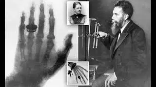 Mechanism of production of X-rays | Tungsten | X-rays |Review-3