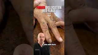 What. NOT To Do With Finger Dislocations⁉️