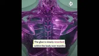New glue stops bleeding in just 15 seconds.