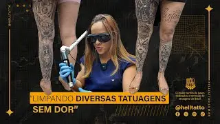 Ela decidiu remover todas as tatuagens da perna de uma só vez | Remoção de Tatuagem Satisfatória