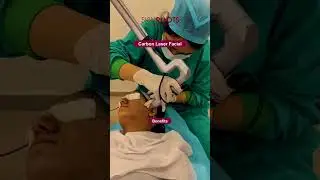 Carbon Facial for Pigmentation &ndash; Even Tone & Glowing Skin