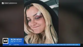 Man accused of hitting singer Bebe Rexha with phone appears in court