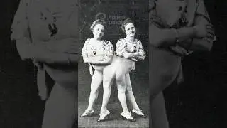 Rosa and Josefa: Conjoined Twins Who Redefined Family and Love