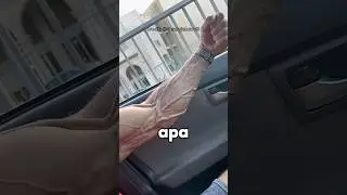 Kenapa Ada Orang Yang Urat Tangannya Menonjol Seperti Ini ⁉️😱