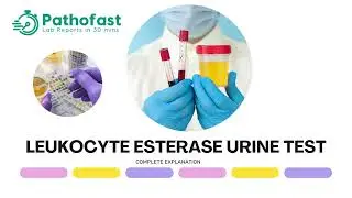 Leukocyte Esterase Urine Test - Everything you need to know