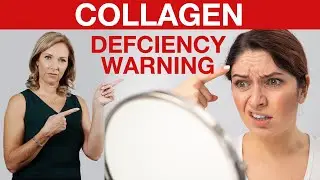 6 Early Warning Signs You May be Low in Collagen | Dr. Janine