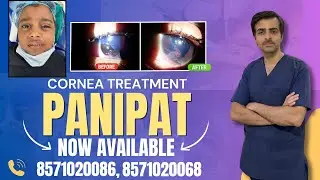 Cornea treatment in Panipat now available. पानीपत में अब कॉर्निया का इलाज उपलब्ध #cornea #treatment