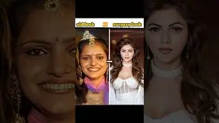 TV serial actress ki old 🆚 surgery look/#trending#viral#