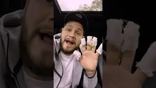 Сожгла отпечатки пальцев на сковороде.. #шорты