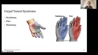 Anatomy related to carpal tunnel syndrome