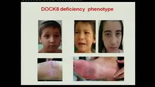 DOCK8 deficiency: Lessons in B-cell biology. By Prof. Raif Geha