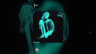 Mysterious three-fingered skeleton found in Peru 🤔