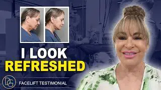 &ldquo;I Look Like Myself, Just Refreshed&rdquo; | Real Reset Facelift & Eyelid Surgery Patient Review