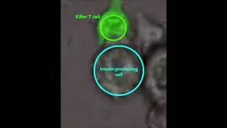 The life (and death) of a pancreatic beta cell