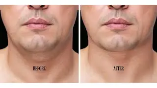 How to remove a double chin in Photoshop