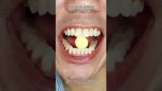 The Most Satisfying Chocolate and Candy ASMR Compilation 🍫🍬 #DoctorTristanPeh #Chocolate #Candy