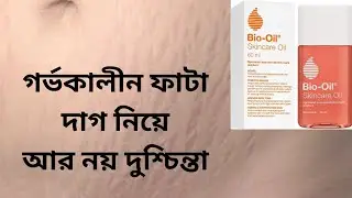 Bio oil review bangla।।গর্ভকালীন ফাটা দাগ দূর করার উপায়।।Bio oil skin care oil for stretchmark।।