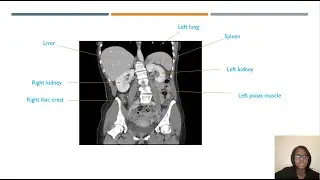 Abdomen: Sectional Anatomy Review for CT Registry/CQR ARRT