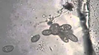 Killer Coleps