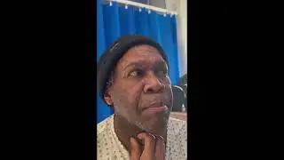 Saccadic Dysmetria - Cerebellar Syndrome