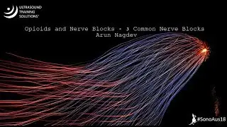 #SonoAus18 | Opioids and Nerve Blocks - 3 common nerve blocks - Arun Nagdev