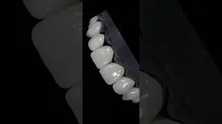 Zirconia crowns are strong, durable, and biocompatible, resist staining and wear, a perfect fit.