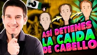 ALOPECIA ANDROGENÉTICA 👨🏻‍🦲 ¿Podemos Detener La Caída Del Pelo? 👦🏻 Efectividad Del Saw Palmetto 🌿