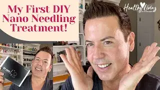 MY FIRST DIY NANO NEEDLING TREATMENT!