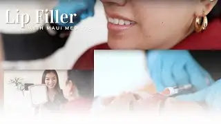 Lip Filler in Austin with Maui Med Spa