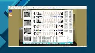 How to Create a Treatment Plan in Eaglesoft