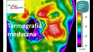 Termografia medyczna